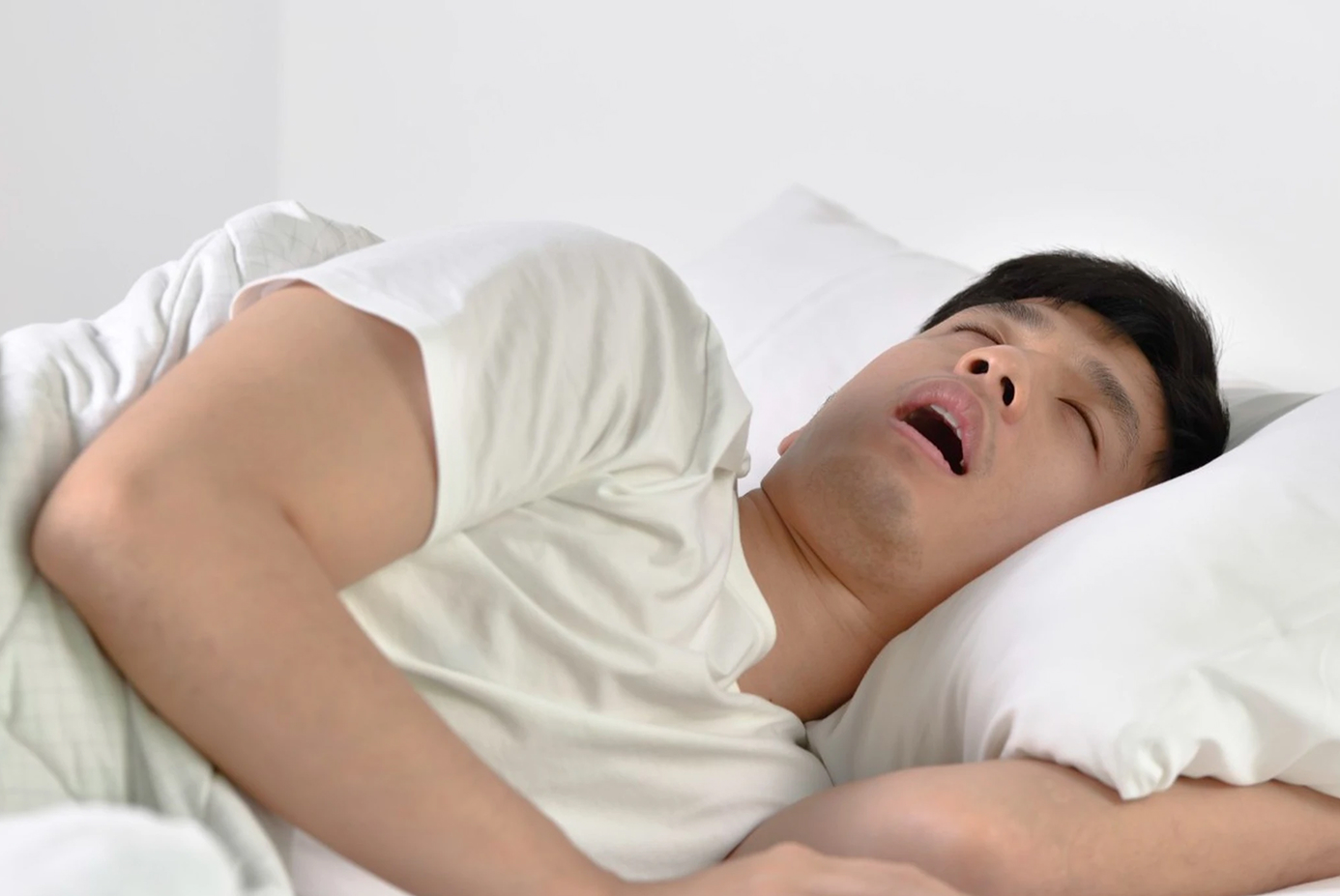睡眠時無呼吸症候群（SAS）